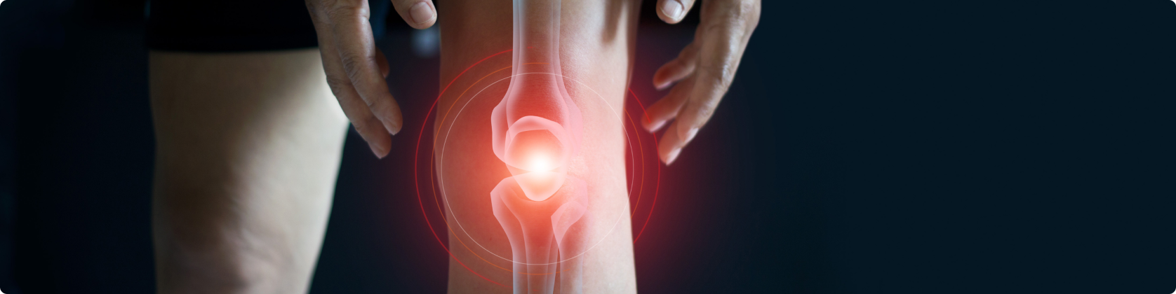 Ρομποτική Ολική Αρθροπλαστική Γόνατος με το Σύστημα ROSA®