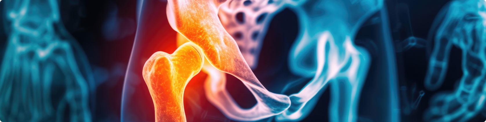 Αναθεώρηση Αρθροπλαστικής Ισχίου