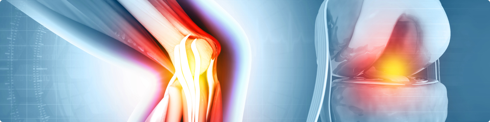 Μονοδιαμερισματική Αρθοπλαστική Γόνατος