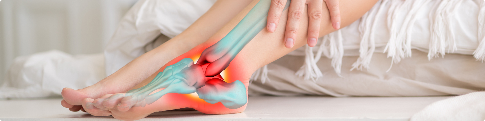 Νεύρωμα Morton