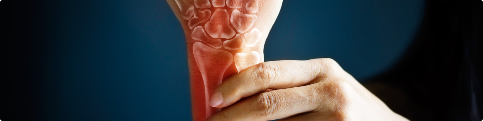 Σύνδρομο Καρπιαίου Σωλήνα