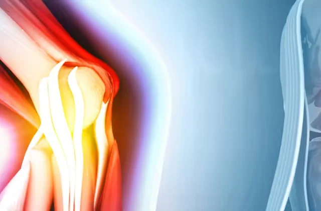 Partial (unicompartmental) knee replacement