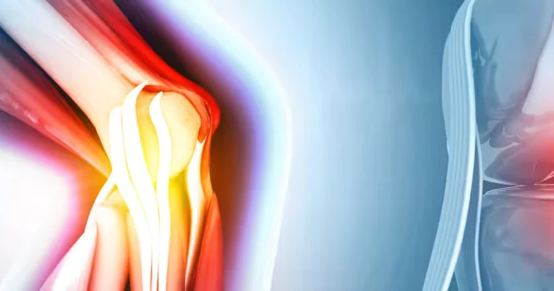 Partial (unicompartmental) knee replacement