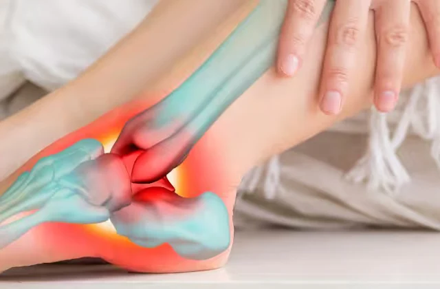 Morton's Neuroma