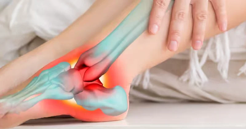 Morton's Neuroma