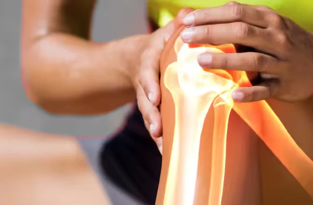Osteonecrosis of the Knee