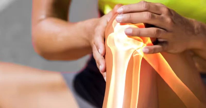 Osteonecrosis of the Knee