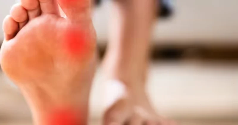Metatarsalgia (Dropped Metatarsals)